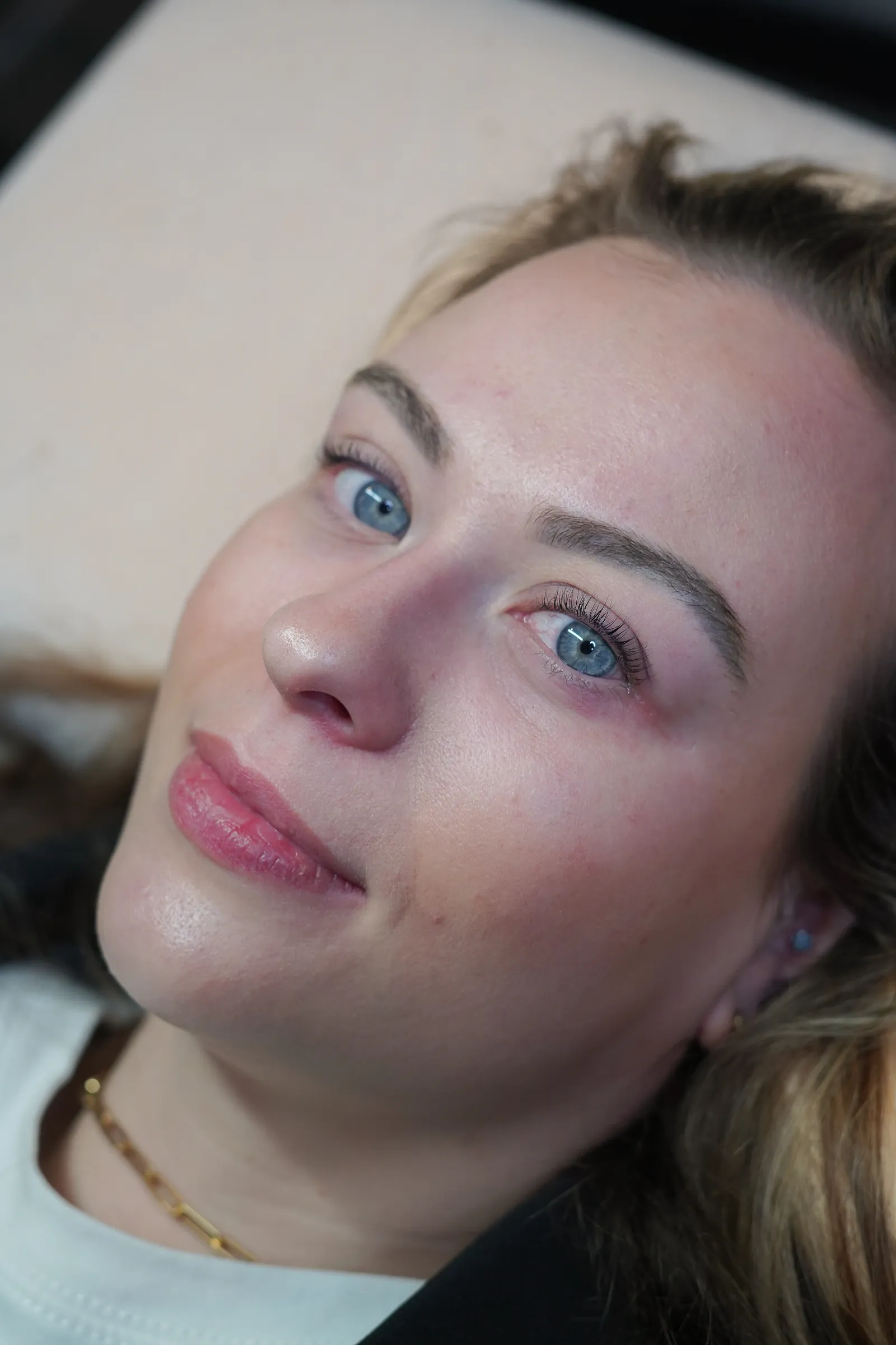 Resultaat van een browlift: volle, opgeborstelde wenkbrauwen